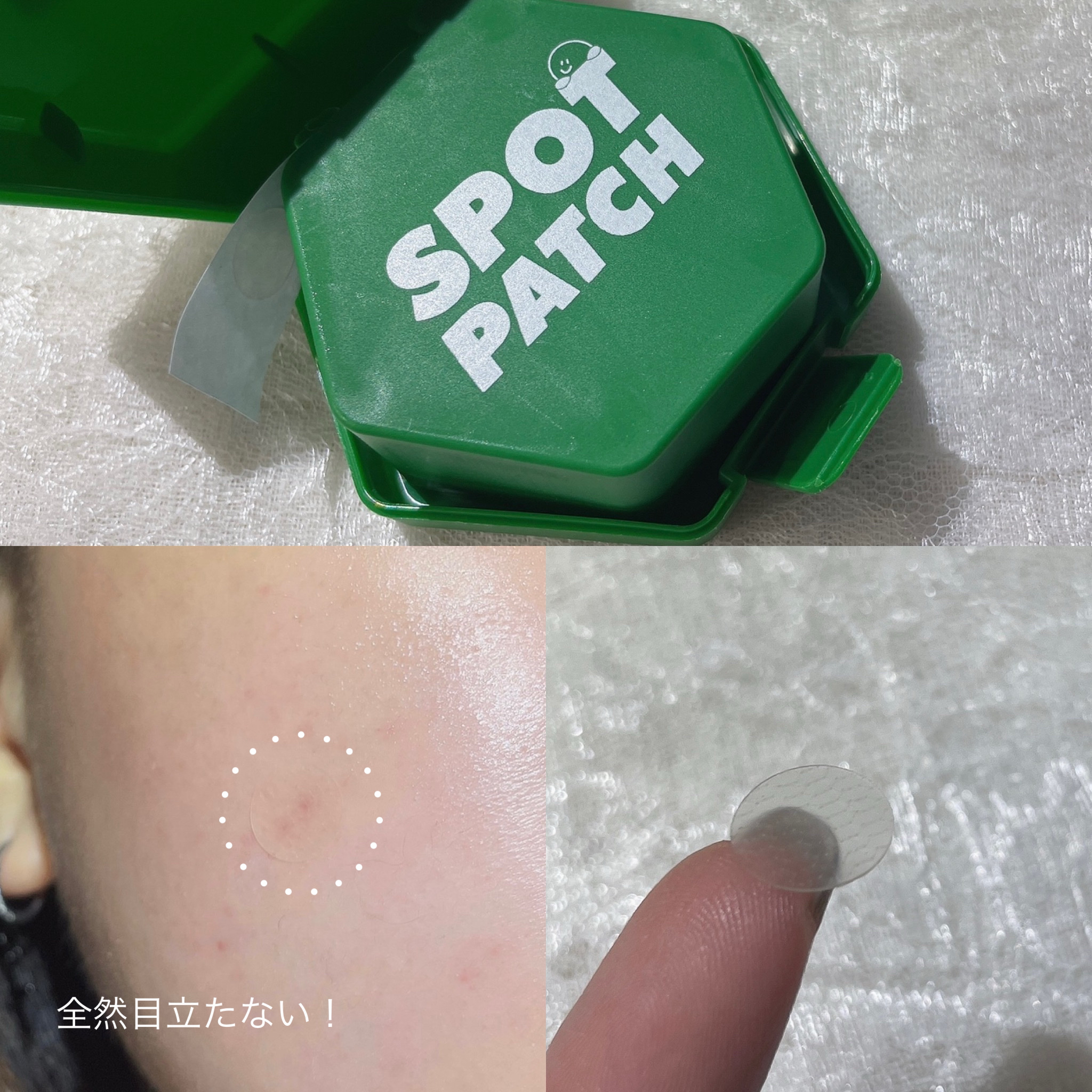 SPOT PATCH ロールタイプ/Shupong/にきびパッチを使ったクチコミ（3枚目）