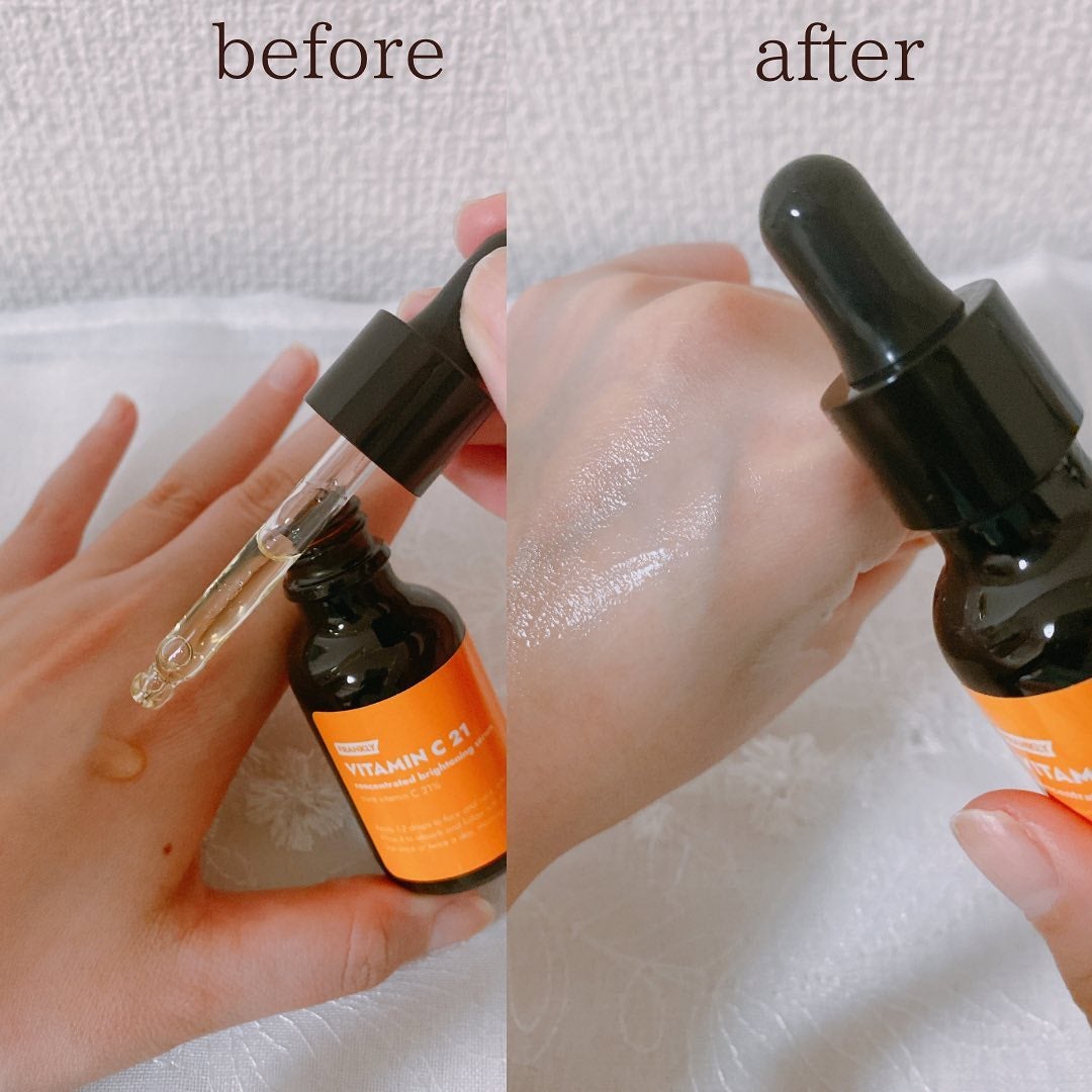 ビタミンC21セラム/Frankly/美容液を使ったクチコミ(2枚目)
