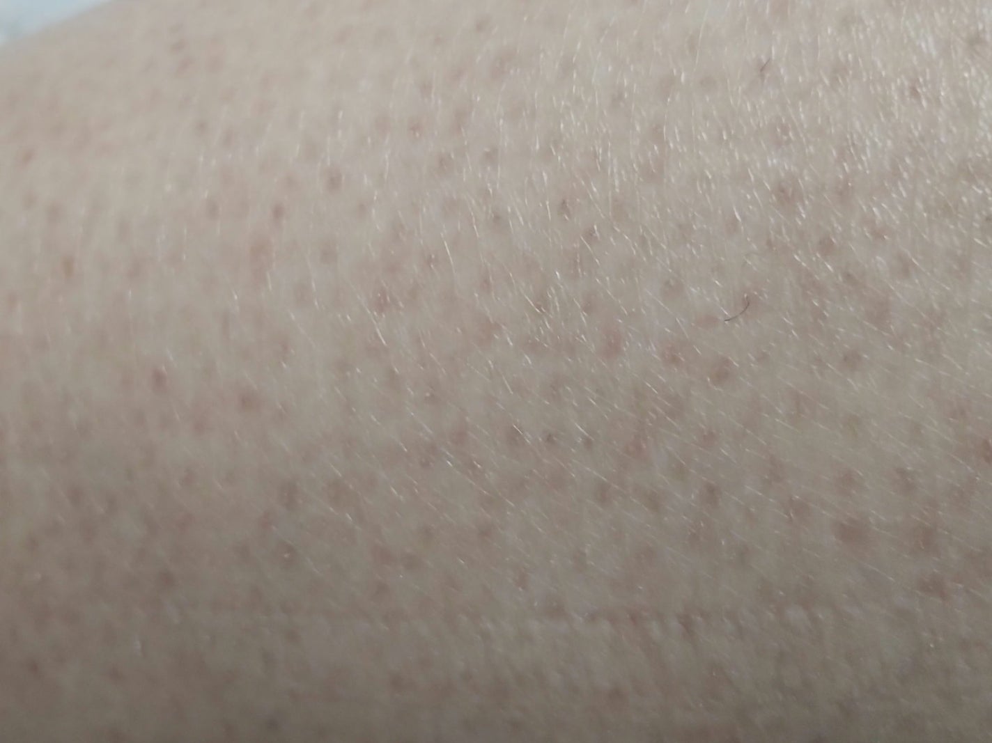 パイナップル豆乳除毛クリーム/鈴木ハーブ研究所/除毛クリームを使ったクチコミ(4枚目)