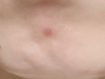 ハトムギ化粧水(ナチュリエ スキンコンディショナー R )/ナチュリエ/化粧水を使ったクチコミ(4枚目)