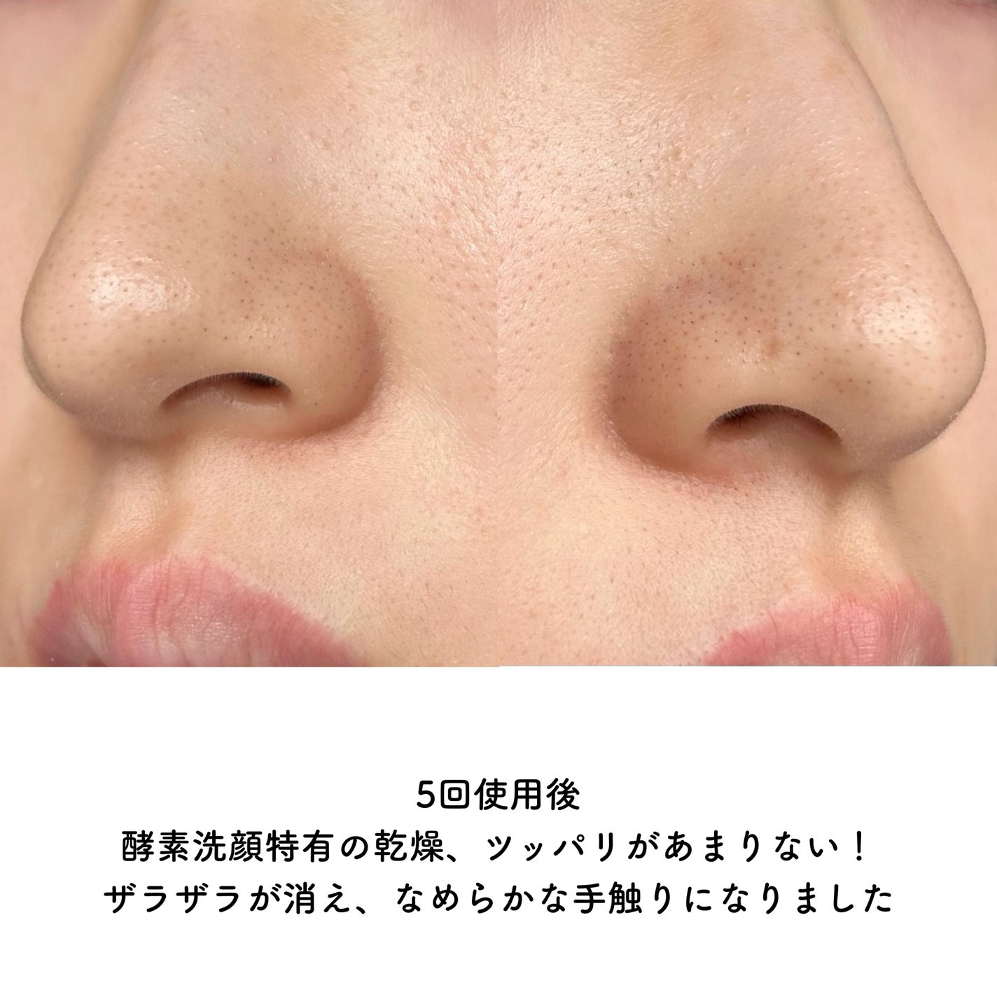 シカカーミングパウダーウォッシュ/TOCOBO/洗顔パウダーを使ったクチコミ(5枚目)