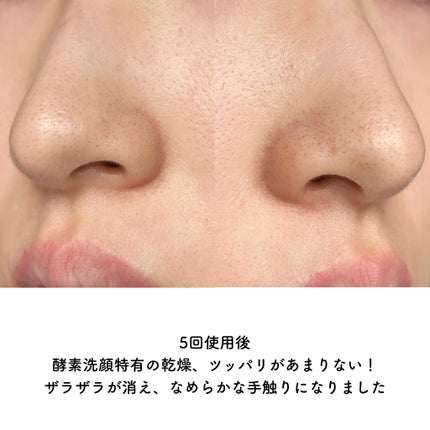 シカカーミングパウダーウォッシュ/TOCOBO/洗顔パウダーを使ったクチコミ(5枚目)