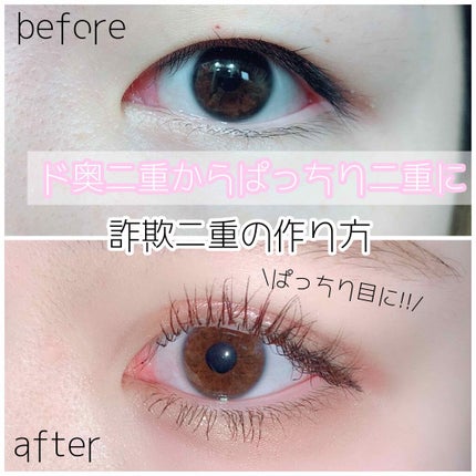 アイテープ 片面テープ ポイント のびーるタイプ ライトピンク/DAISO/二重まぶた用アイテムを使ったクチコミ(1枚目)