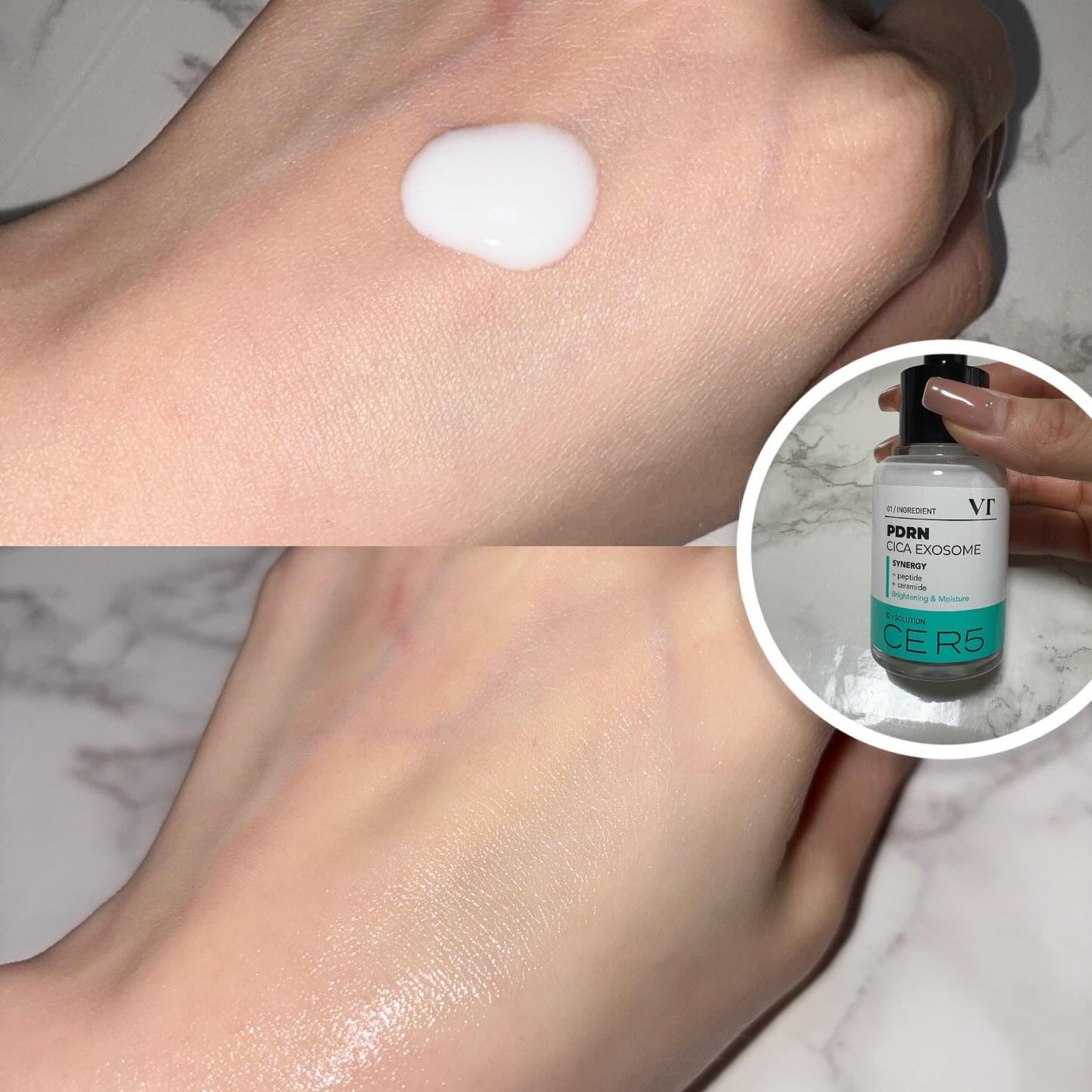 PDRN+リードルS 100/VT/美容液を使ったクチコミ(4枚目)