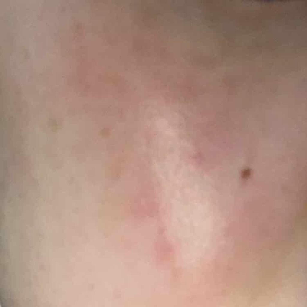 モイスチュア リポソーム/DECORTÉ/美容液を使ったクチコミ（2枚目）