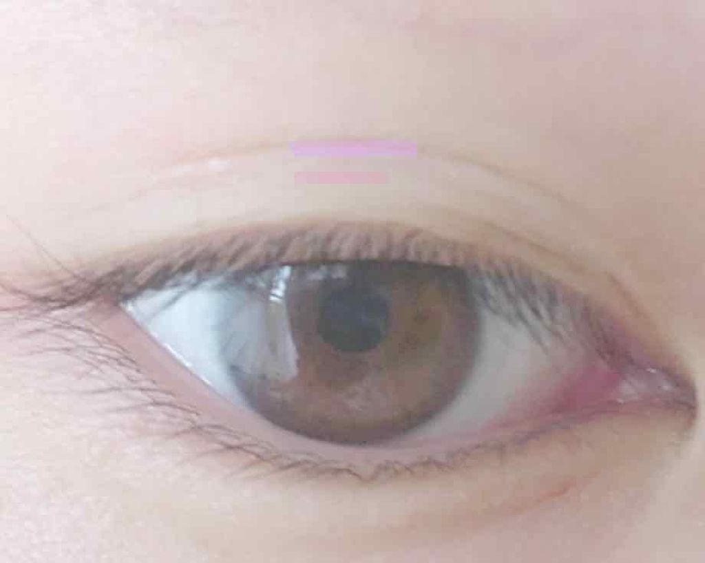 【旧品】オリシキ アイリッドスキンフィルム/D-UP/二重まぶた用アイテムを使ったクチコミ（2枚目）