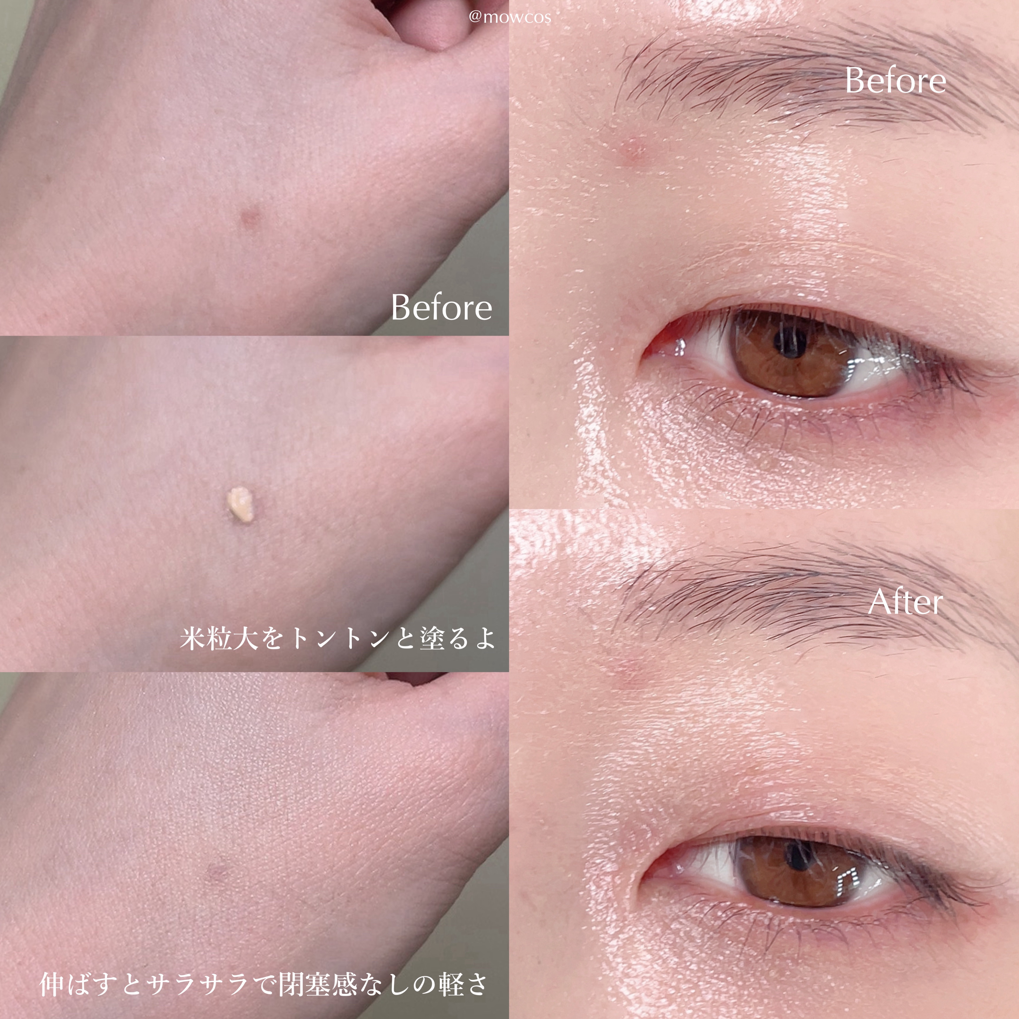 イプノス シーバムクリア リペアクリーム/ACSEINE/フェイスクリームを使ったクチコミ（3枚目）