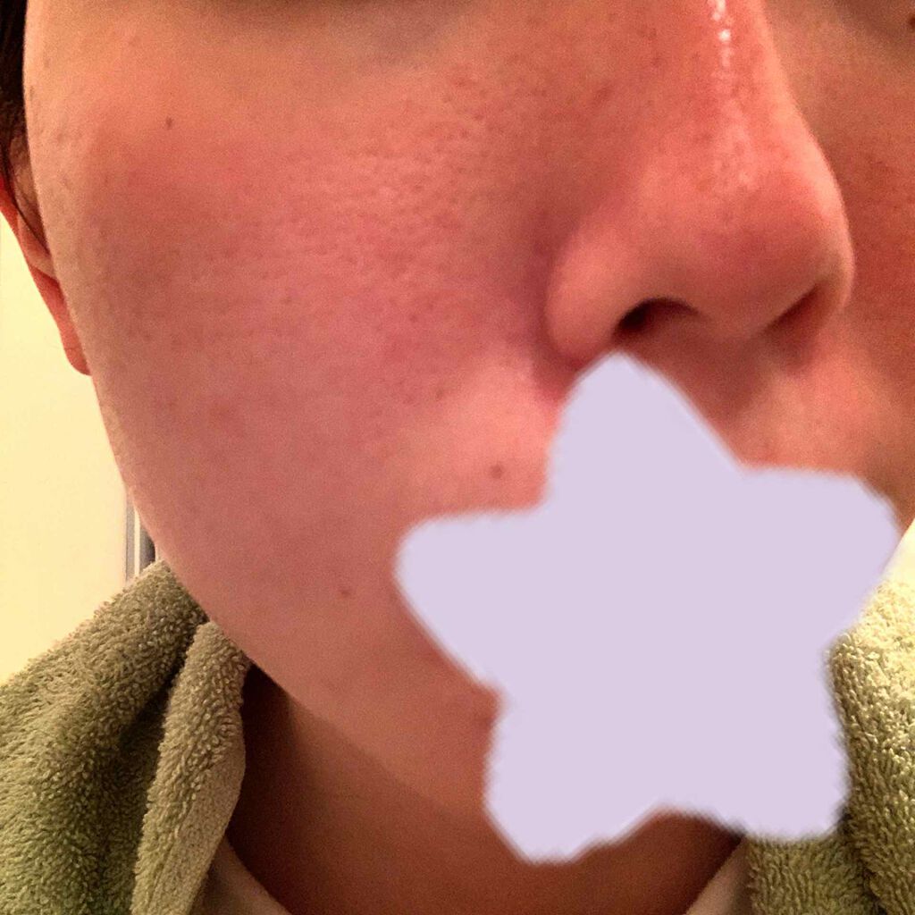 潤い濃密化粧水/ももぷり/化粧水を使ったクチコミ（3枚目）