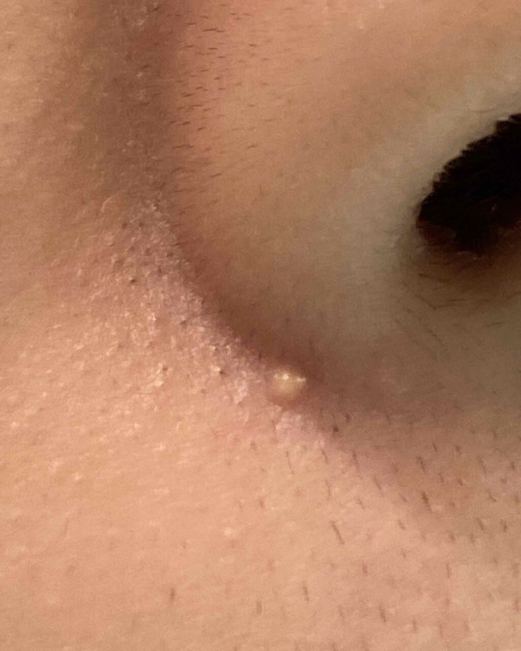 薬用しみ対策 美白ミスト化粧水/メラノCC/ミスト状化粧水を使ったクチコミ（2枚目）