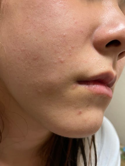 詩乃 on LIPS 「こんばんわ😌詩乃です!今日、初投稿させていただきます!最近、肌..」(4枚目)