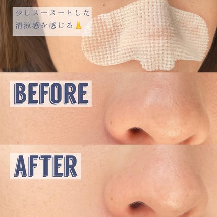 ノーモアブラックヘッド(ノーズピーリング)/One-day's you/スクラブ・ゴマージュを使ったクチコミ(3枚目)