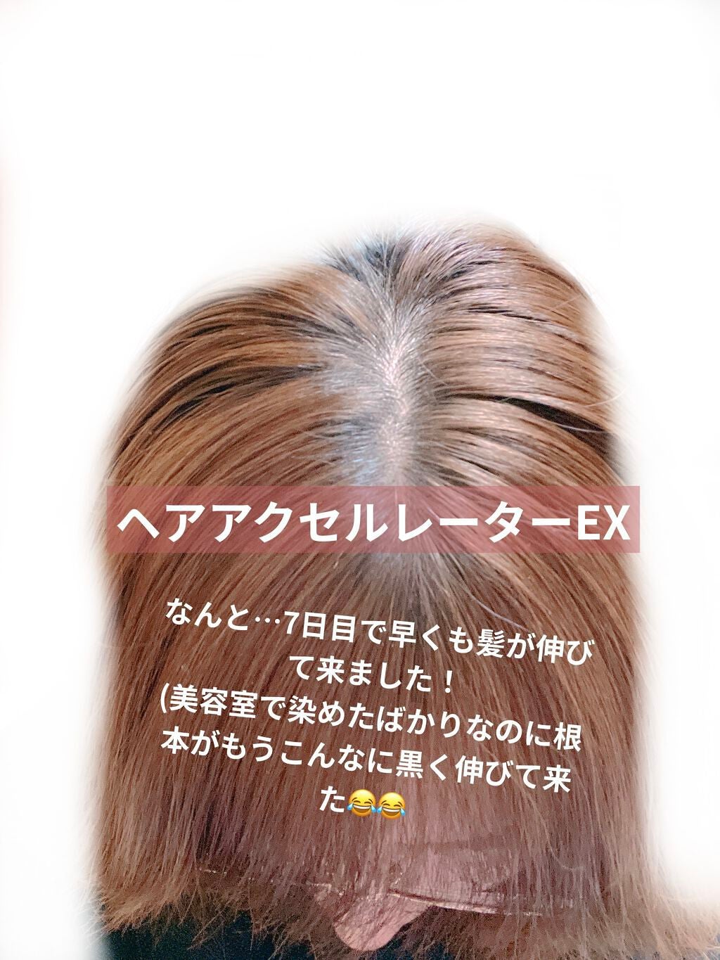 ヘアアクセルレーターEX フローラルアップルの香り/加美乃素本舗/頭皮ローションを使ったクチコミ(1枚目)