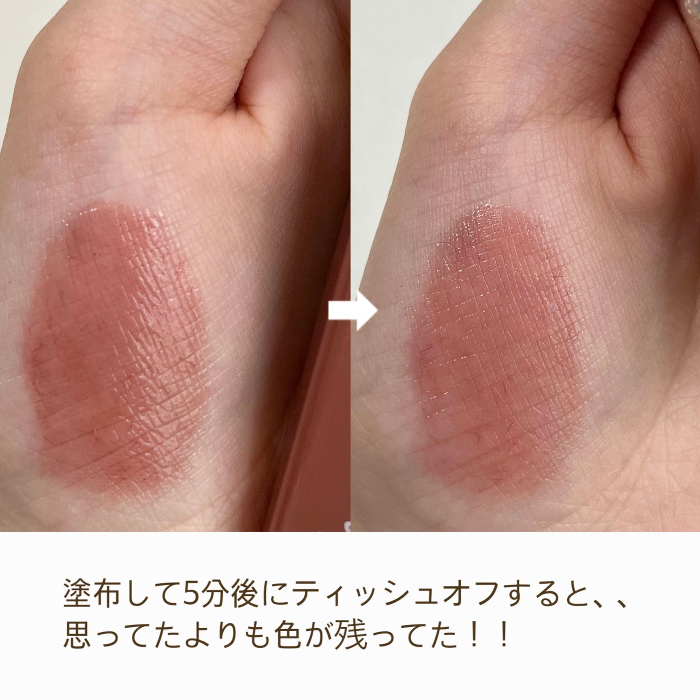 プランピーリップ/Fujiko/リップグロスを使ったクチコミ(5枚目)