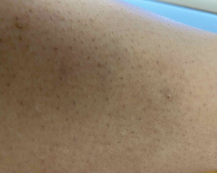 ꪔ̤̮ˊˎ˗ on LIPS 「閲覧注意⚠助けて下さい…。私は高校1年生で毎日制服でスカートを..」(2枚目)