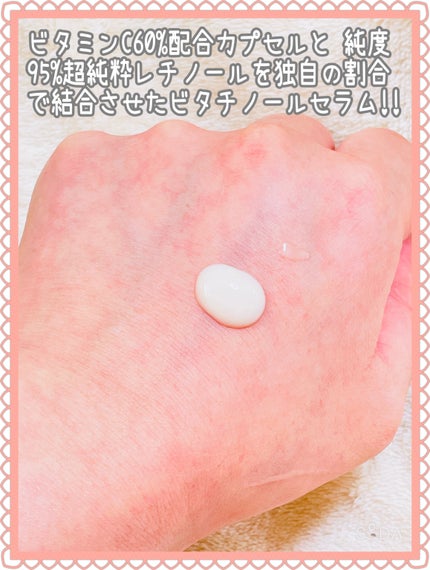 ユース ラディアンス ビタチノール セラム/primera/美容液を使ったクチコミ(3枚目)