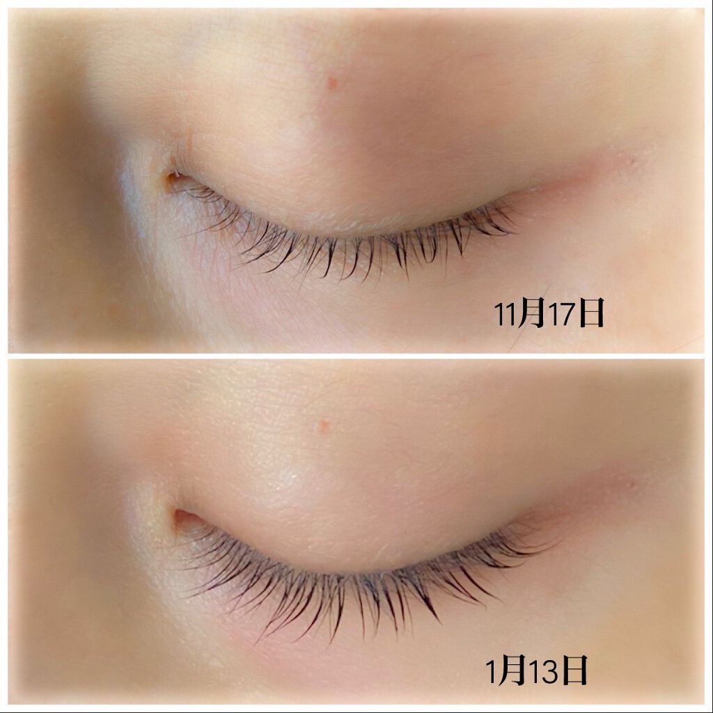 スカルプD ボーテ ピュアフリーアイラッシュセラム/アンファー(スカルプD)/まつげ美容液を使ったクチコミ(2枚目)