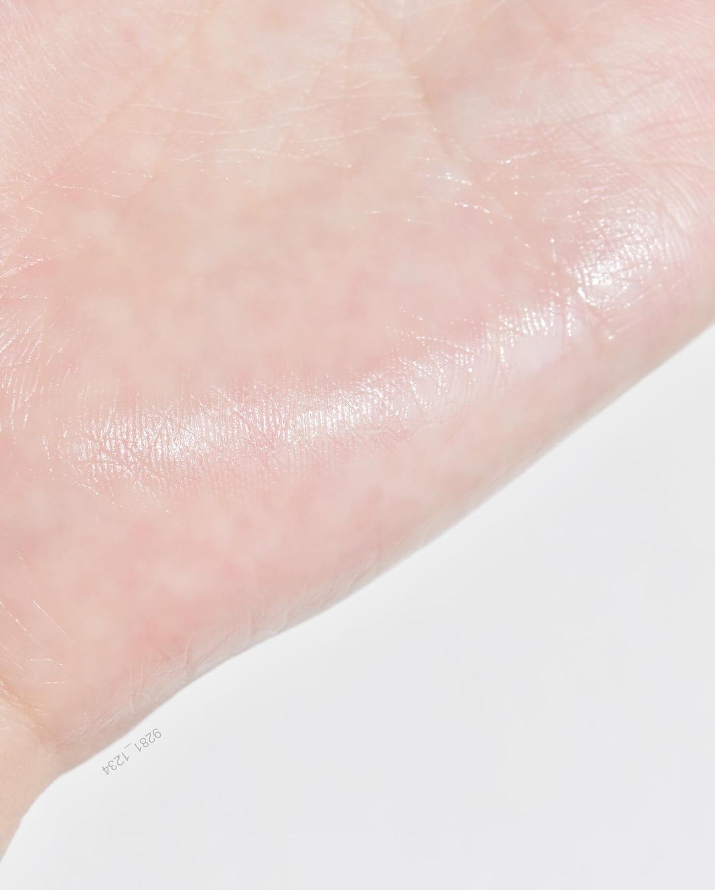 ノスカナイン トラブル セラム/FATION/美容液を使ったクチコミ(4枚目)