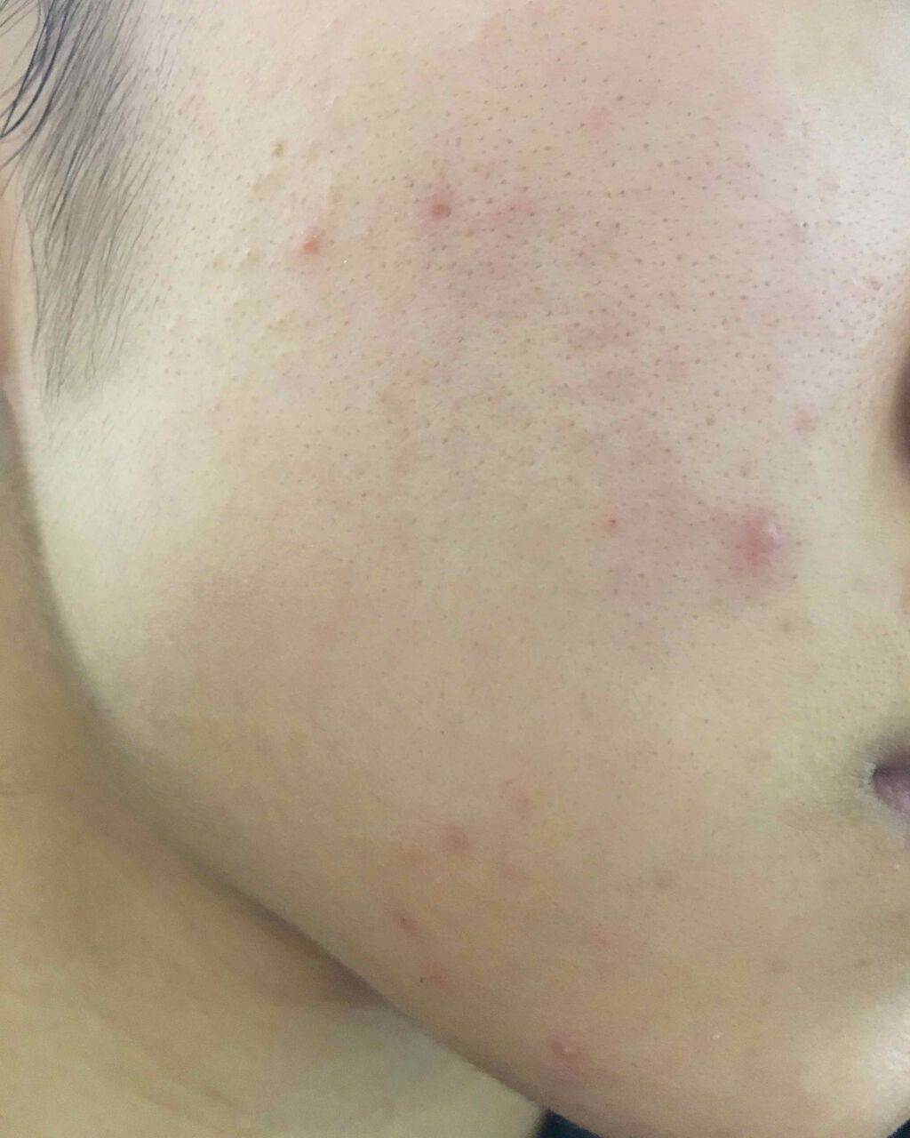 敏感肌用薬用美白美容液/無印良品/美容液を使ったクチコミ(3枚目)