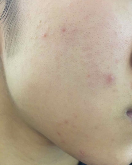 敏感肌用薬用美白美容液/無印良品/美容液を使ったクチコミ(3枚目)