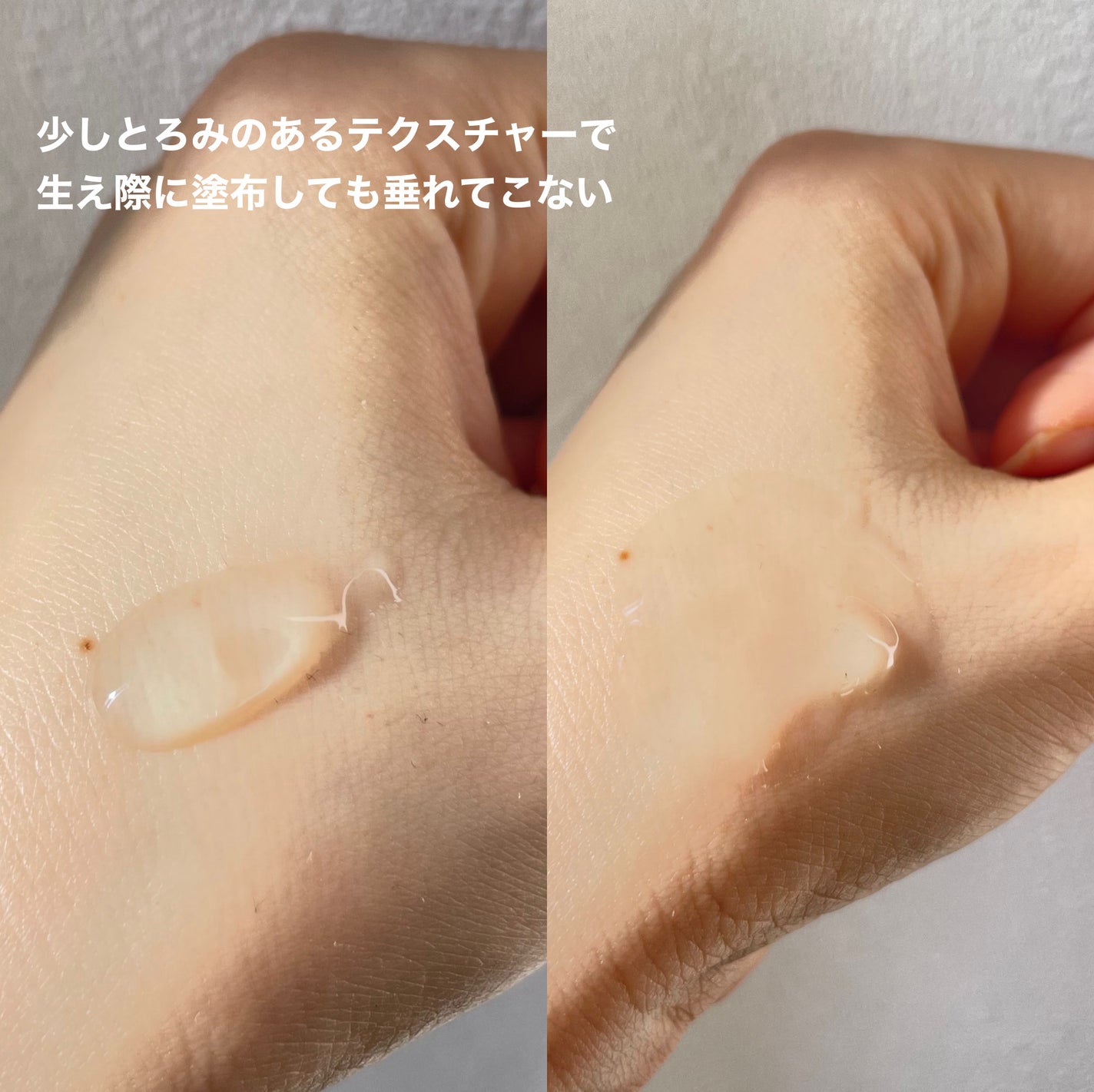 ナノグロウリッチ/iqumore/頭皮ローションを使ったクチコミ(3枚目)