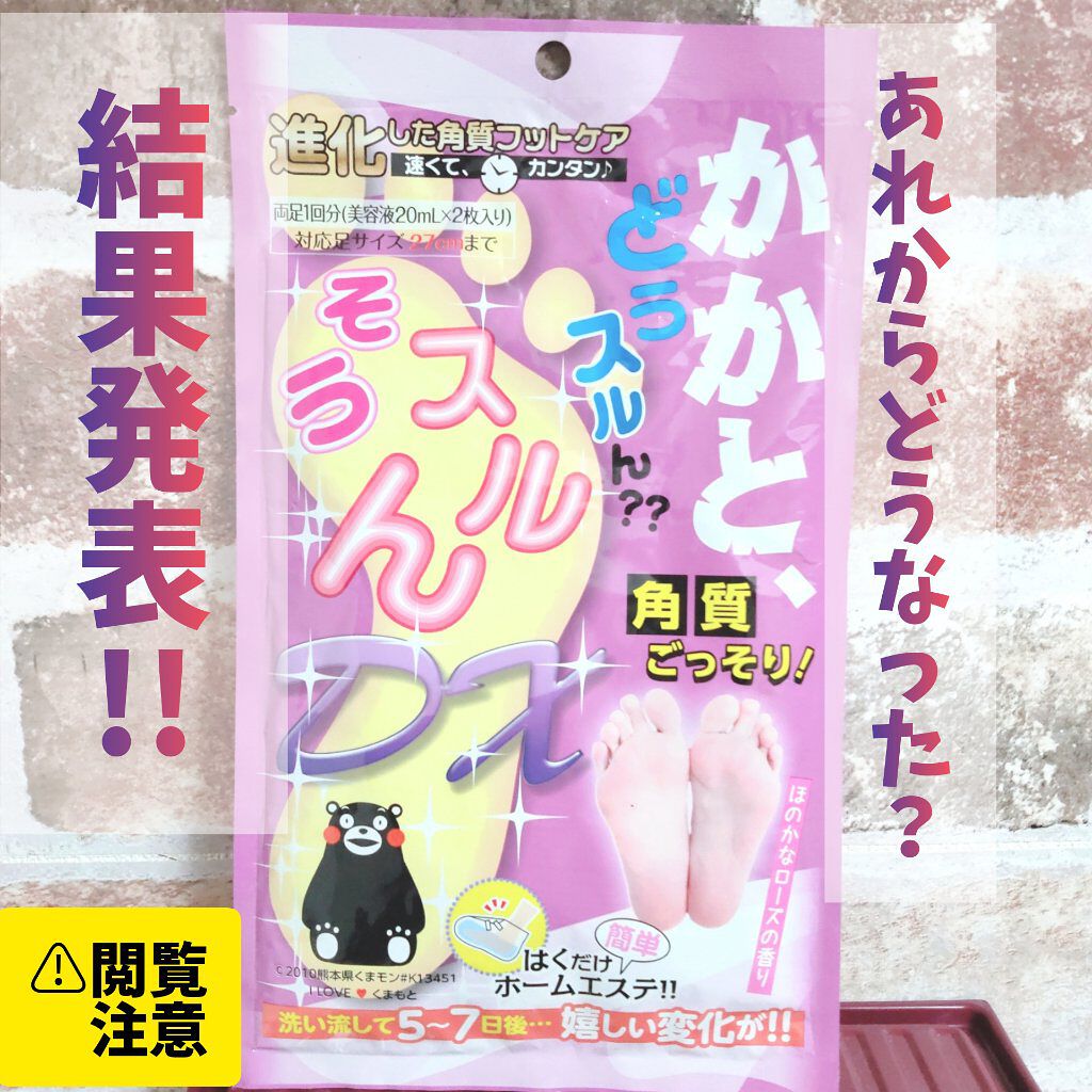 かかと どうスルん？？そうスルんDX/Stay Free/レッグ・フットケアを使ったクチコミ（1枚目）