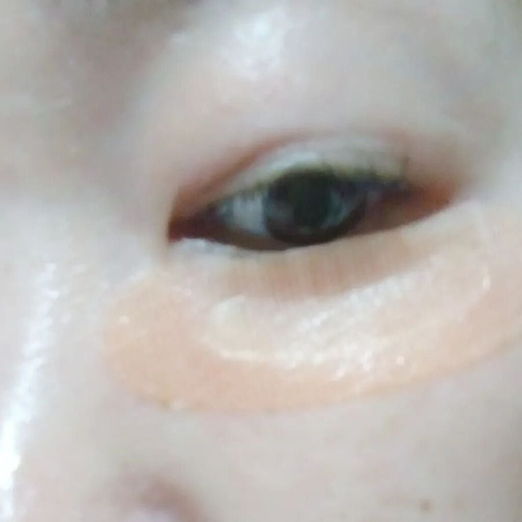 クオニス ダーマフィラープレミア/Quanis/シートマスク・パックを使ったクチコミ(4枚目)