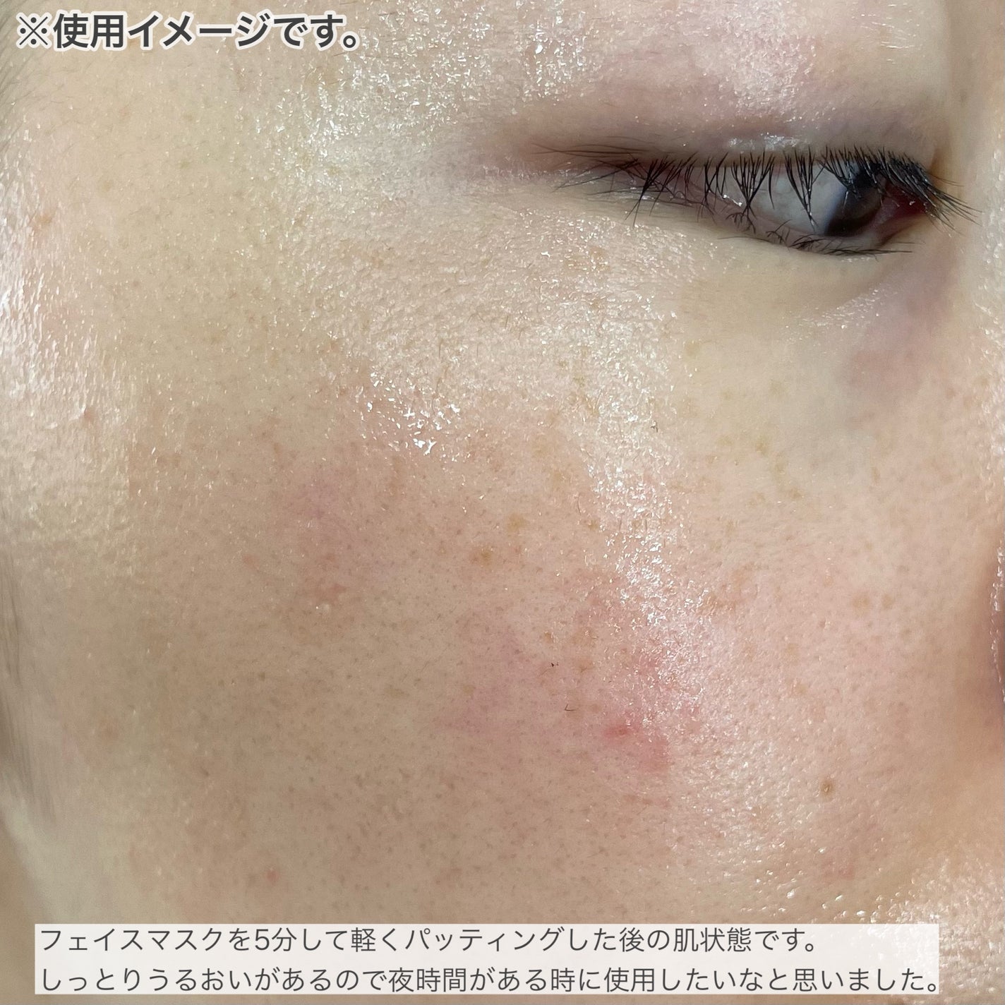 薬用ルルルン 美白アクネ/ルルルン/シートマスク・パックを使ったクチコミ(8枚目)