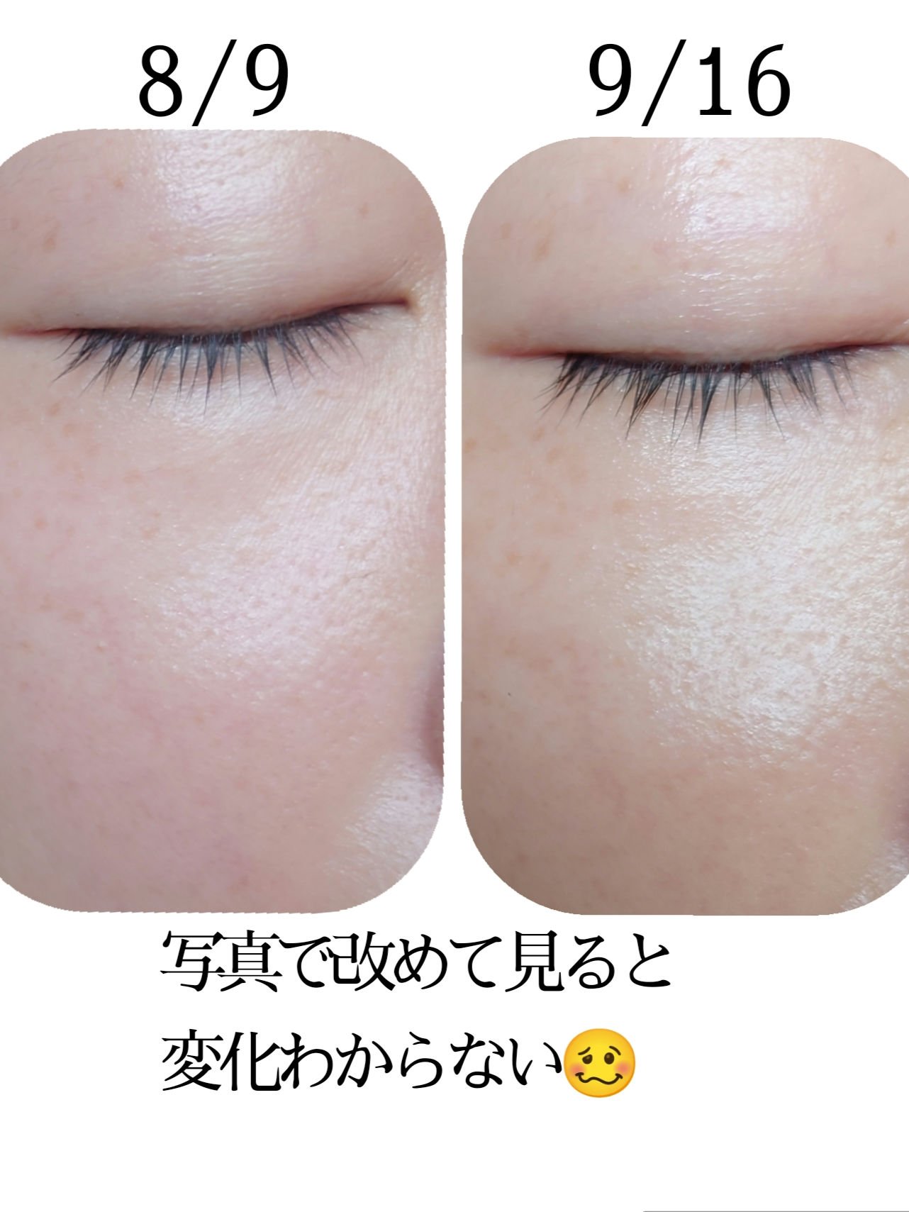 ビタサプリECB2B6顆粒s(医薬品)/サンドラッググループ/その他を使ったクチコミ（2枚目）