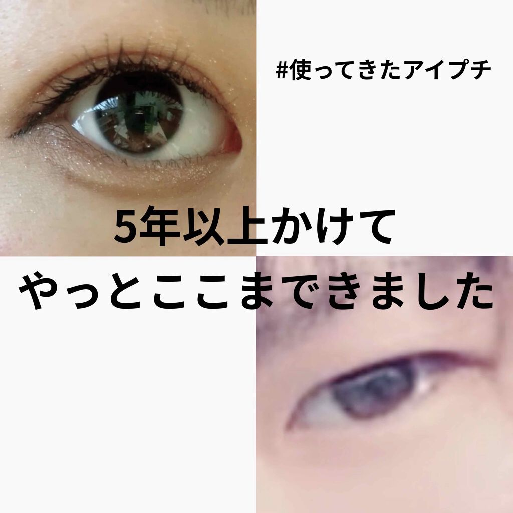 アイビューティー フィクサー WP/アストレア ヴィルゴ/二重まぶた用アイテムを使ったクチコミ(1枚目)