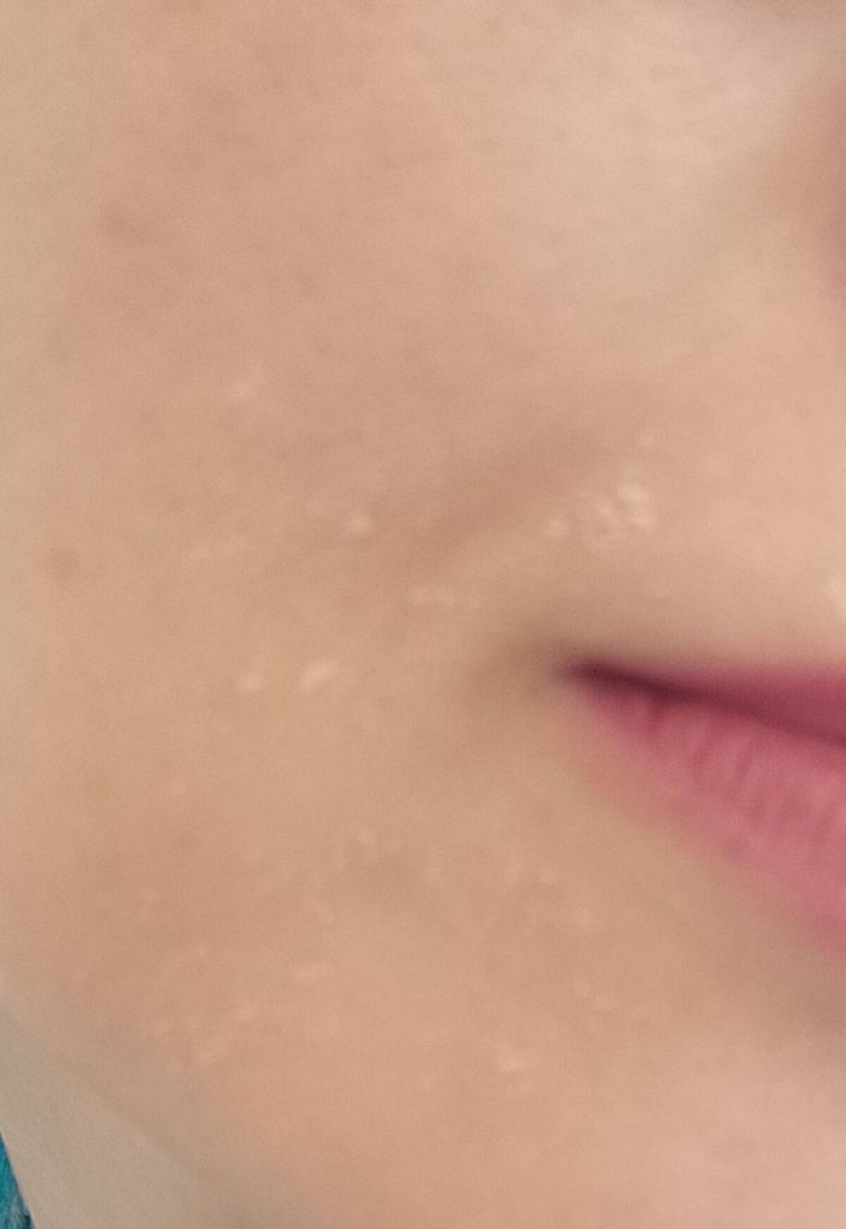 Retinol 1% in Squalane/The Ordinary/美容液を使ったクチコミ（1枚目）