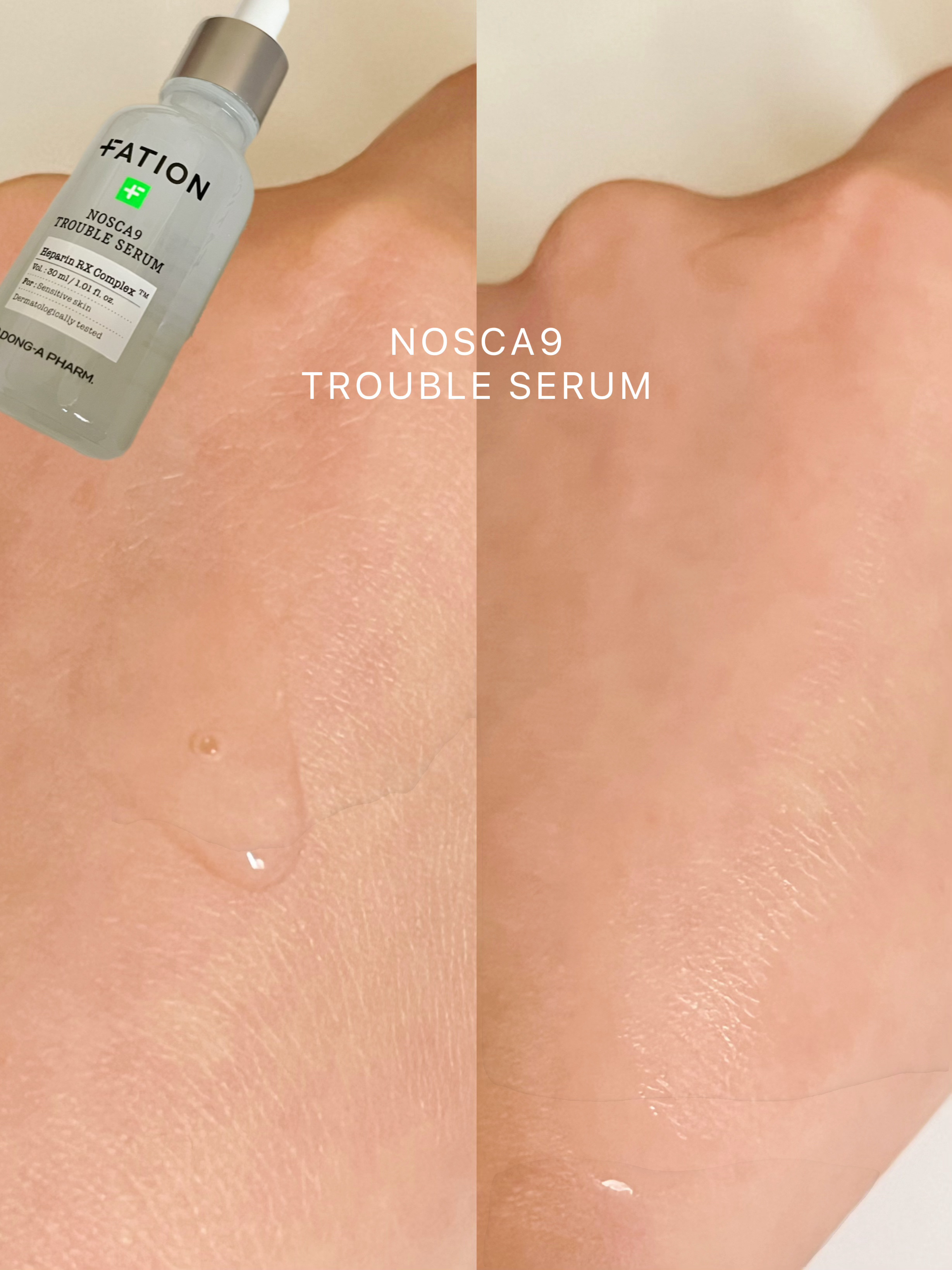 ノスカナイン トラブル セラム/FATION/美容液を使ったクチコミ（3枚目）