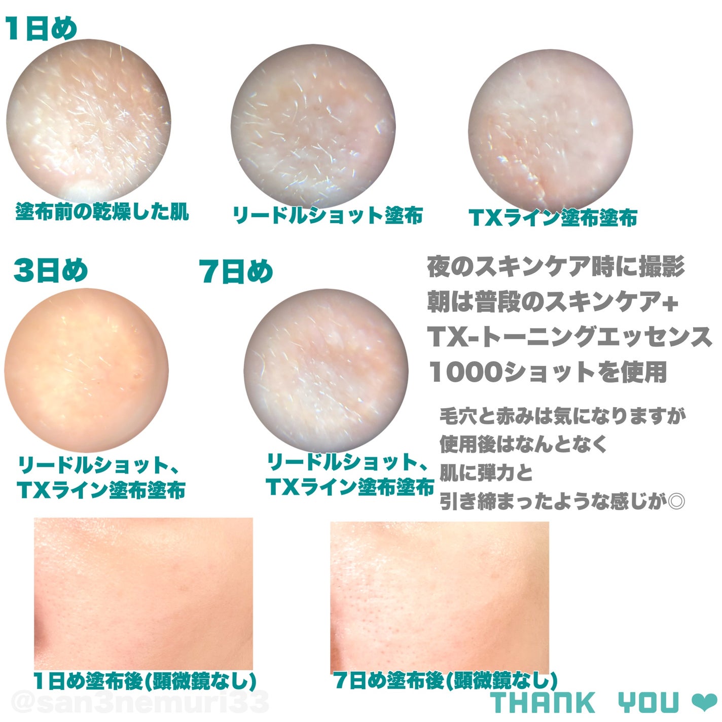 リードルショット300/VT/美容液を使ったクチコミ(4枚目)