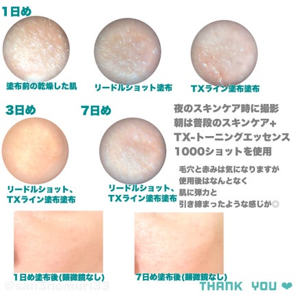 リードルショット300/VT/美容液を使ったクチコミ(4枚目)