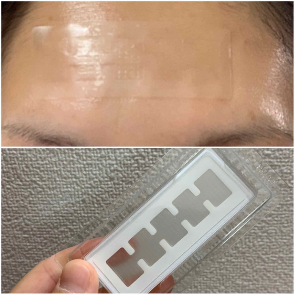 オデコディープパッチ/北の快適工房/シートマスク・パックを使ったクチコミ（2枚目）