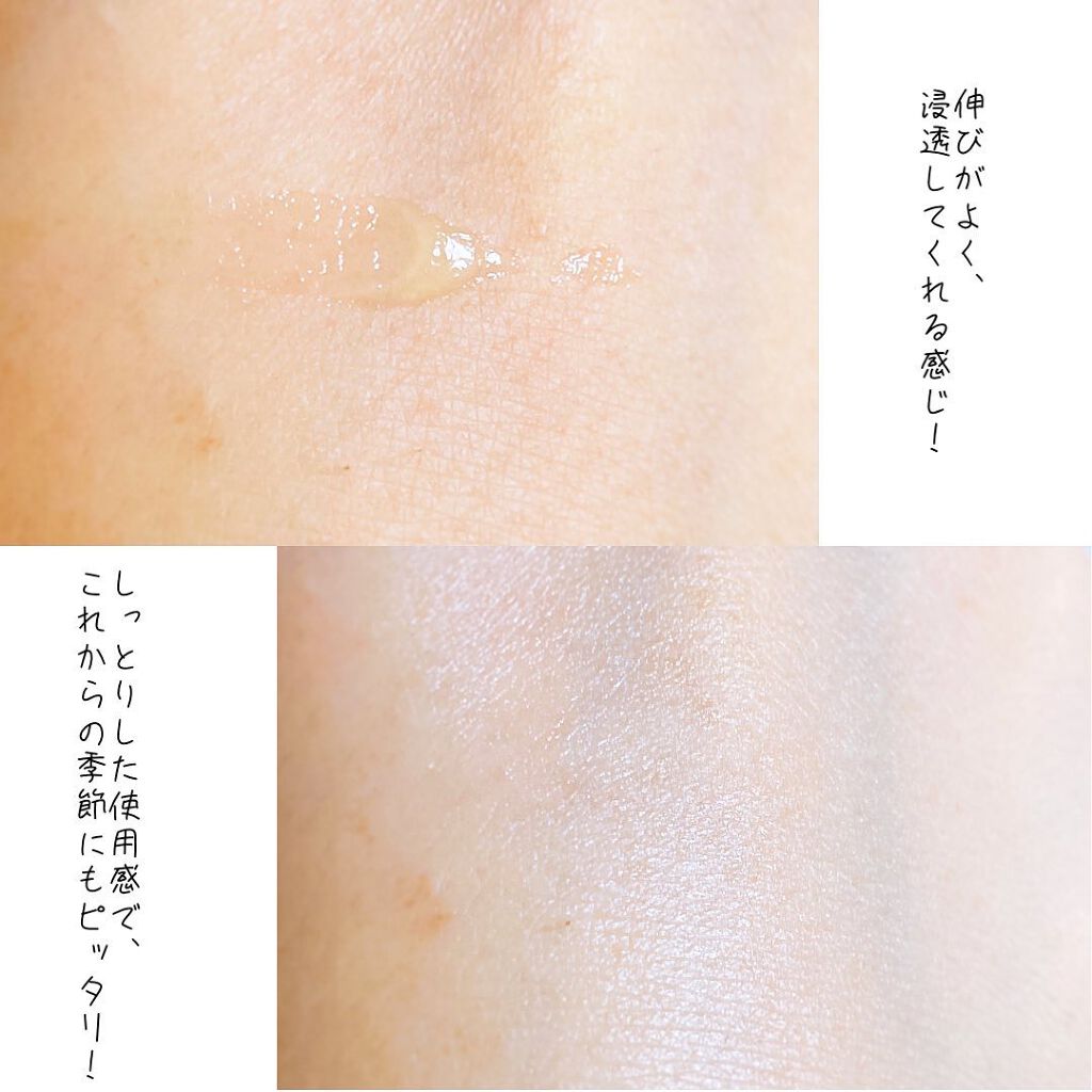 Lip Medex/Blistex/リップバームを使ったクチコミ(5枚目)