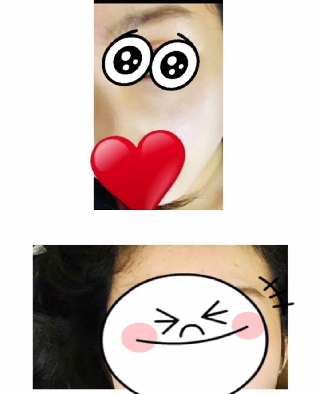 A アクネフォーム/NOV/洗顔フォームを使ったクチコミ（2枚目）