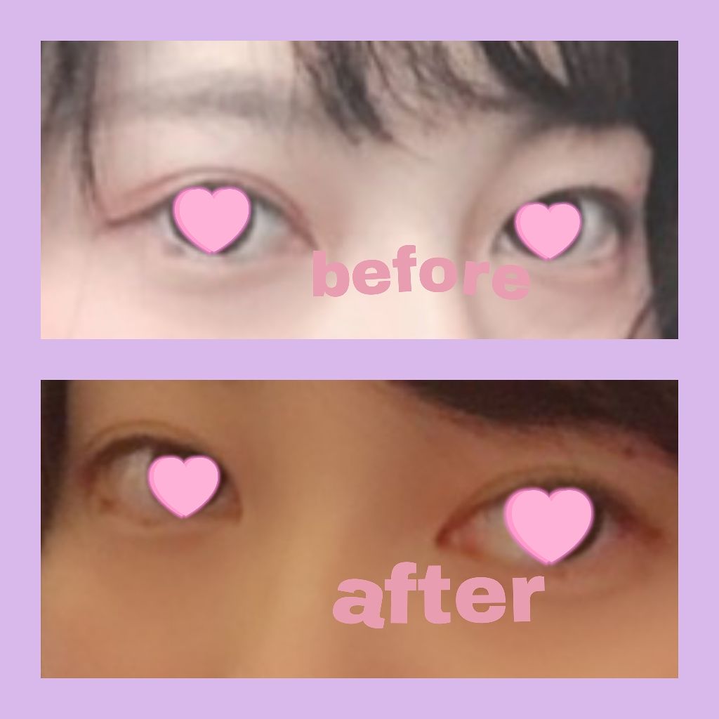 二重まぶた用シール/DAISO/二重まぶた用アイテムを使ったクチコミ(4枚目)