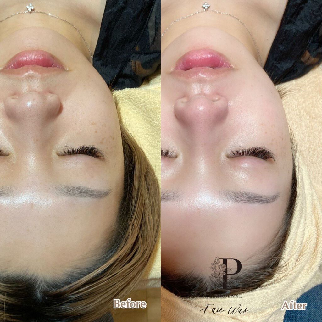 マデカクリーム/センテリアン24/フェイスクリームを使ったクチコミ（1枚目）