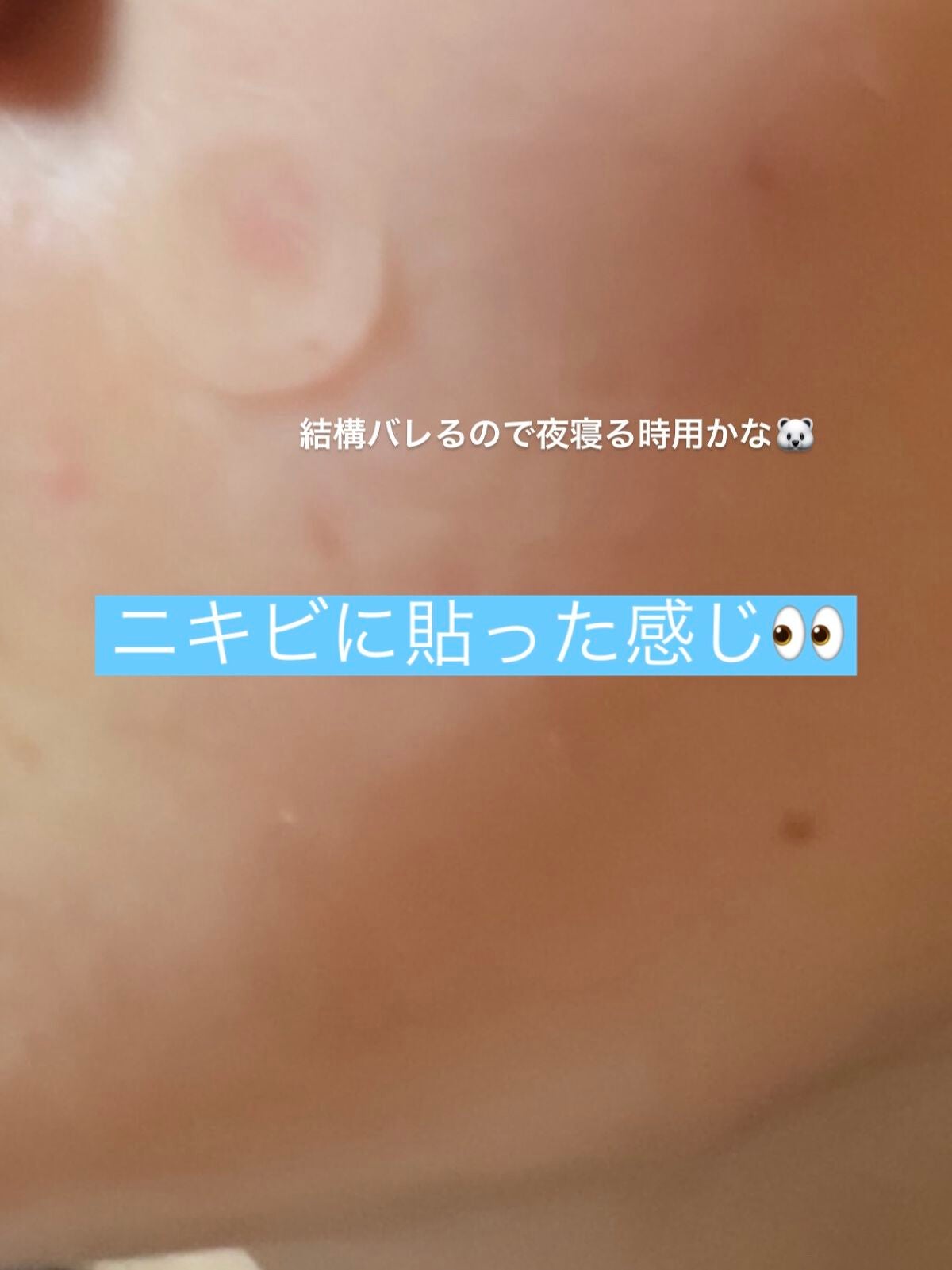 トラブルキュア/美肌ファクトリー/シートマスク・パックを使ったクチコミ(2枚目)