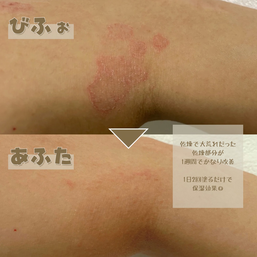 スーパーナッツナリッシングバーム/ナッツセリン/ボディクリームを使ったクチコミ（2枚目）