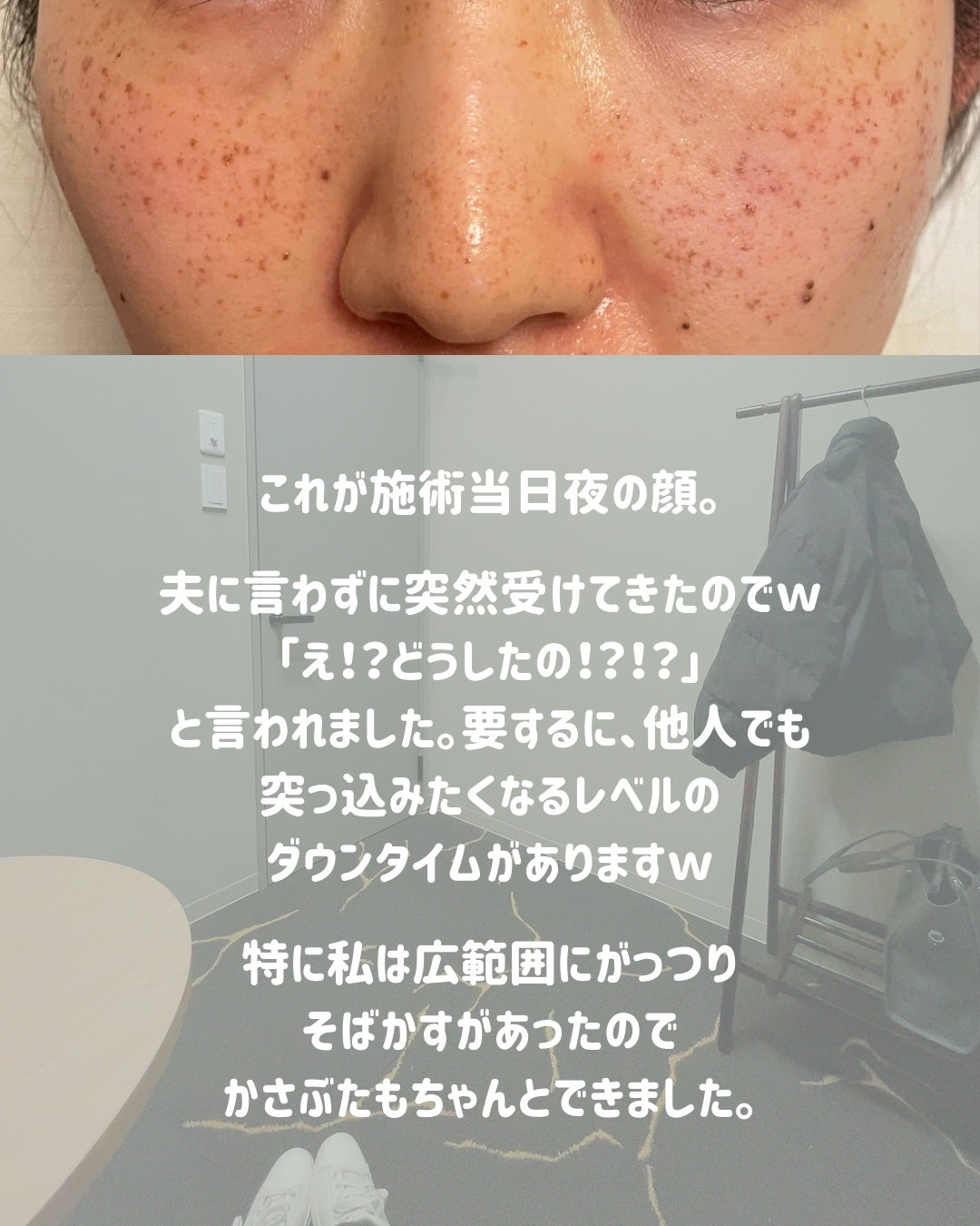 ビオレUV アクアリッチ アクアプロテクトローション(水層パック)/ビオレ/日焼け止めローションを使ったクチコミ(5枚目)