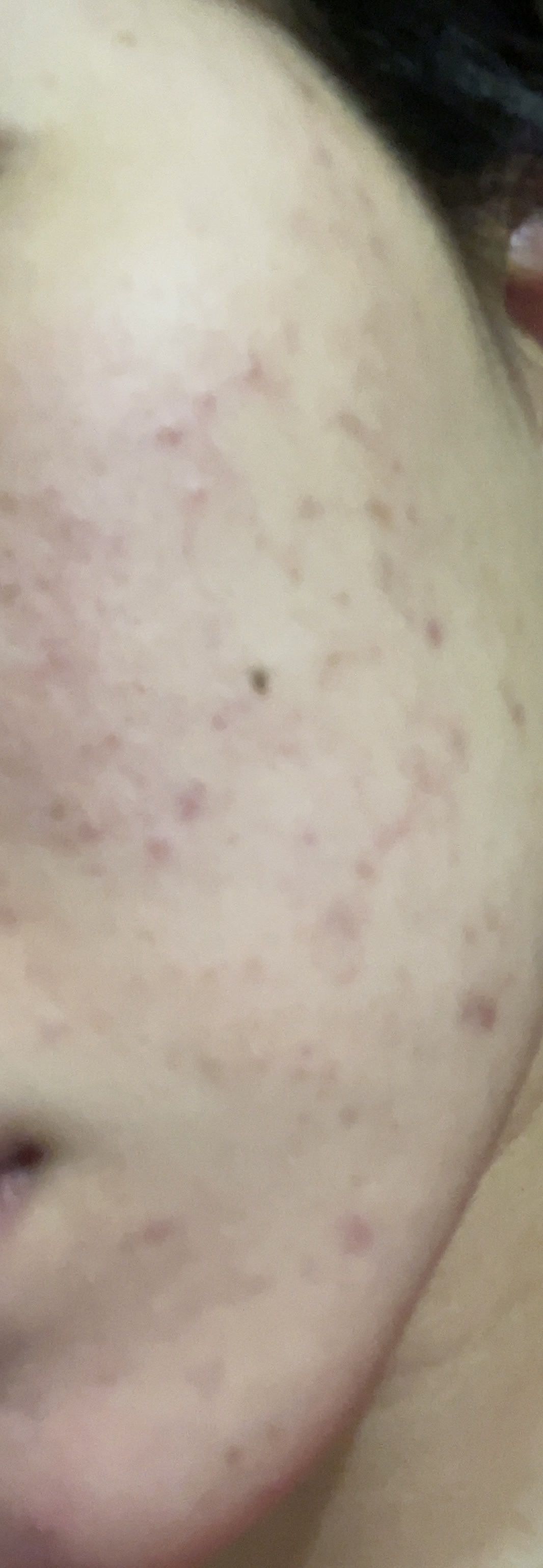 皮脂トラブルケア 保湿ジェル/キュレル/化粧水を使ったクチコミ（3枚目）