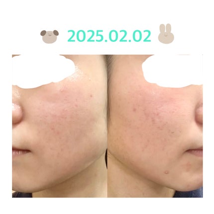 を使ったクチコミ(1枚目)