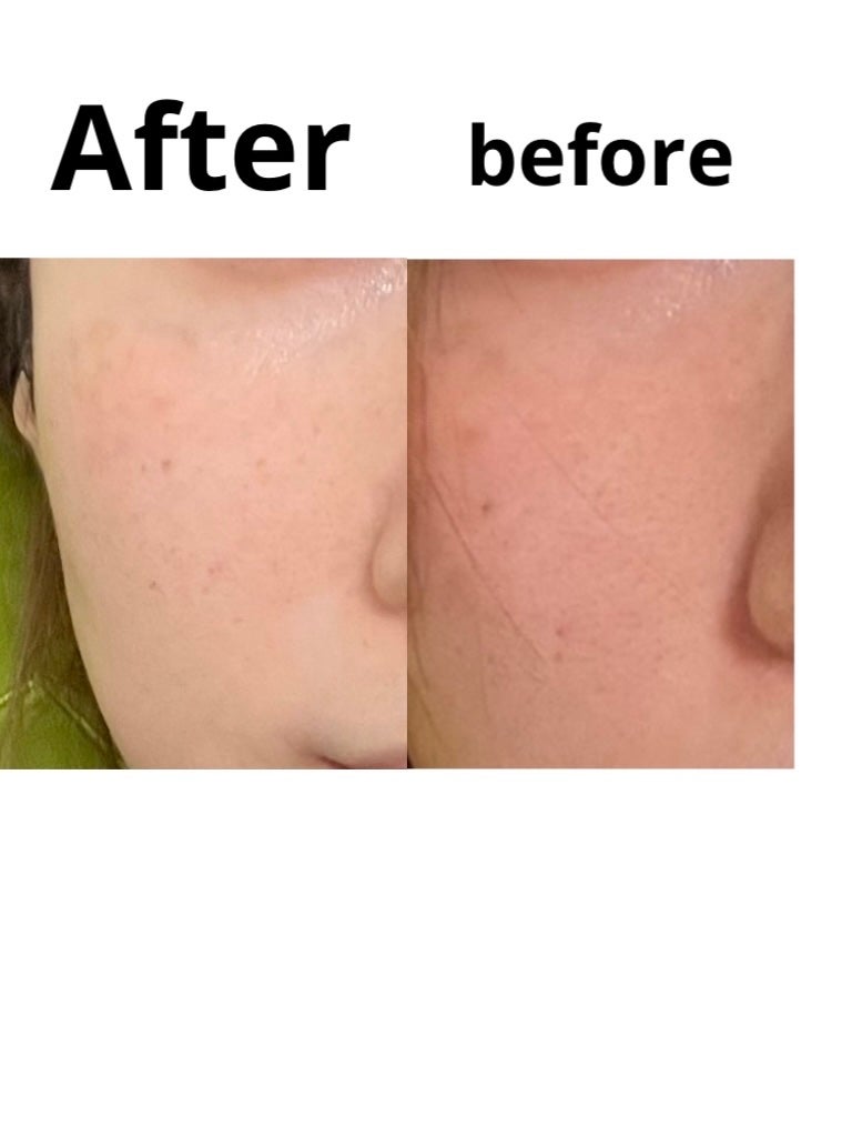 REPAIR CONTROL GEL DRESSING MASK SEET/Easydew/シートマスク・パックを使ったクチコミ(1枚目)