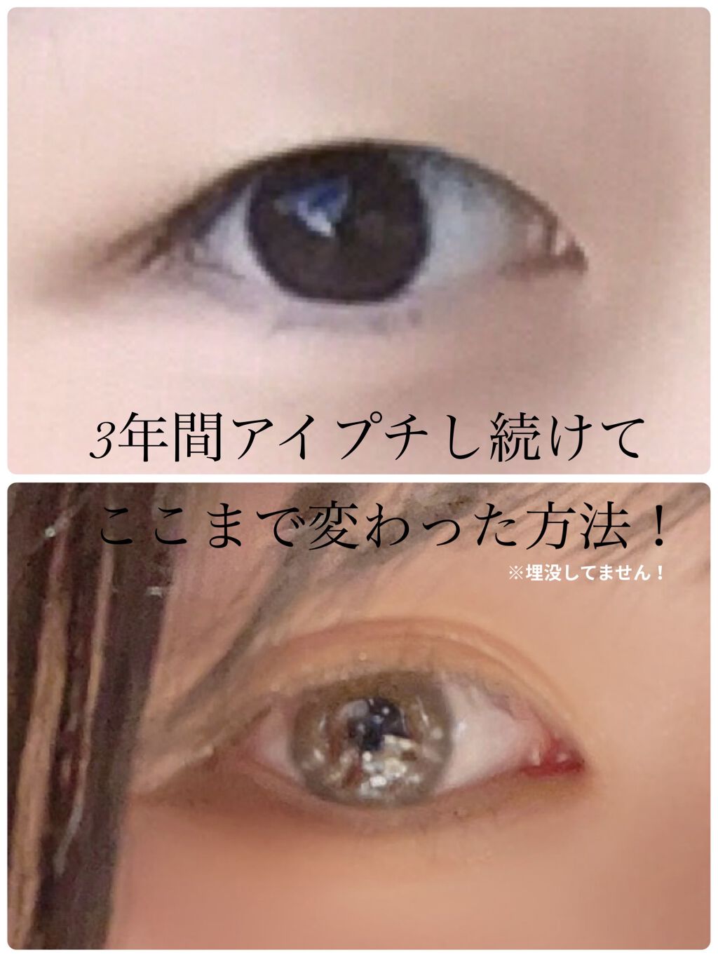 アイトーク/アイトーク/二重まぶた用アイテムを使ったクチコミ（1枚目）