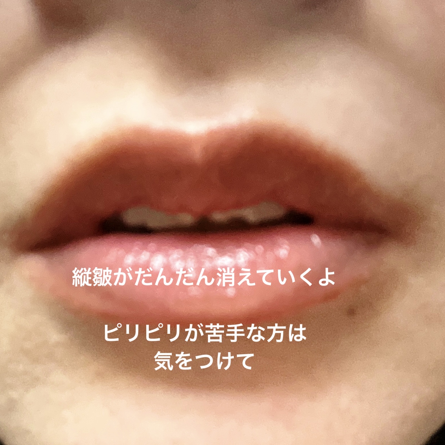 マッドピーチウォータートックスリッププランパー 01 CLEAR/MAD PEACH/リッププランパーを使ったクチコミ（3枚目）