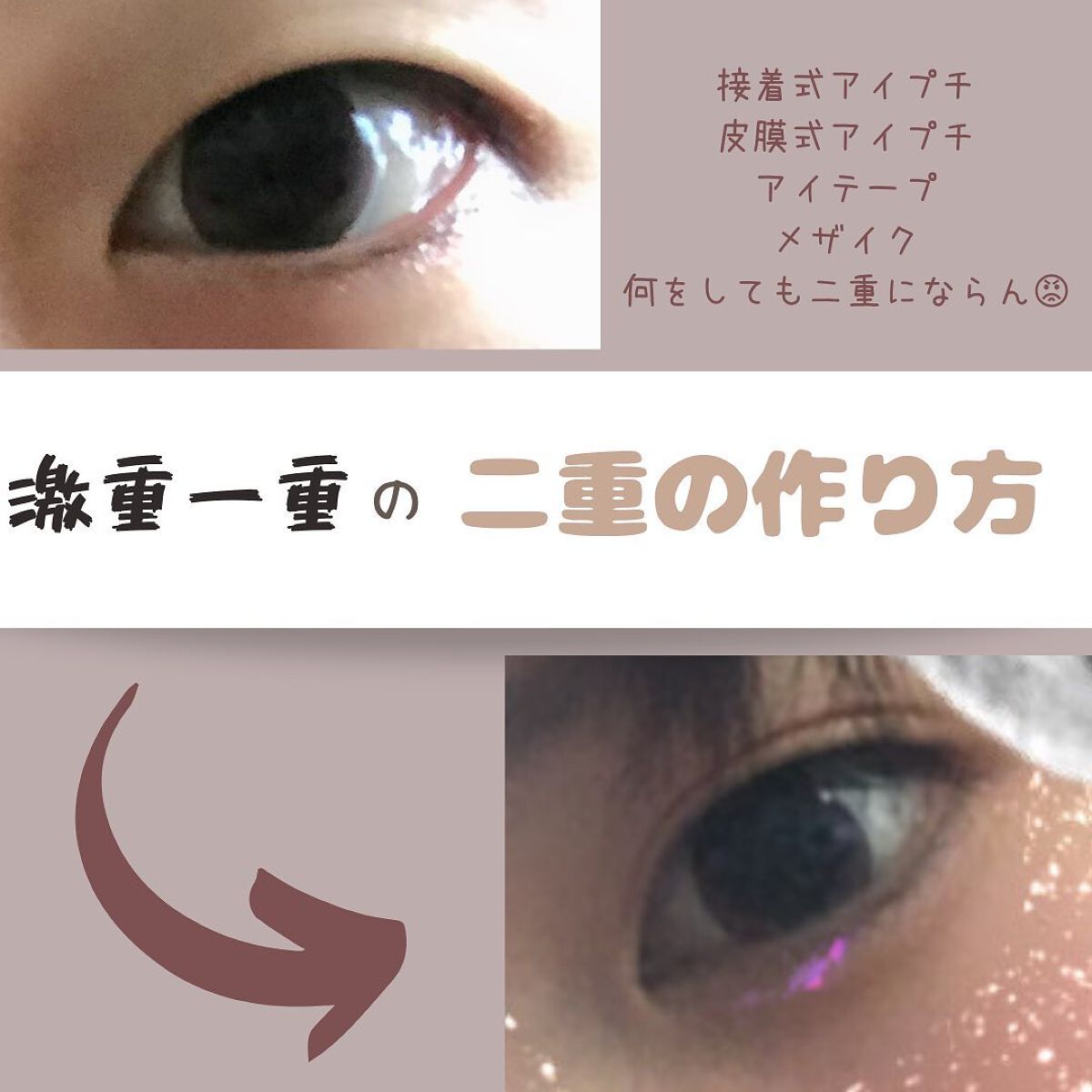 アイビューティー フィクサー WP/アストレア ヴィルゴ/二重まぶた用アイテムを使ったクチコミ(1枚目)