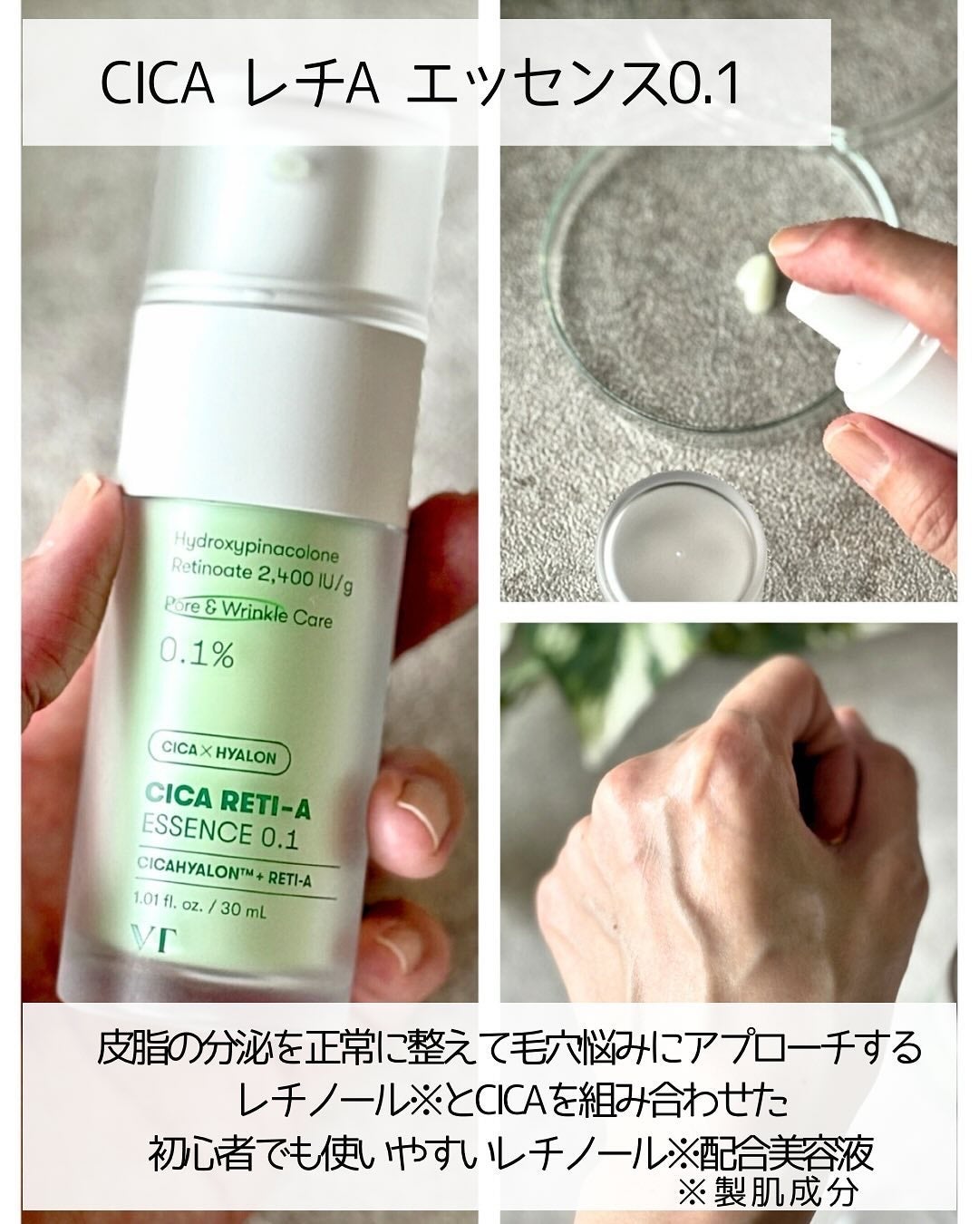 シカレチA エッセンス0.1/VT/美容液を使ったクチコミ(6枚目)