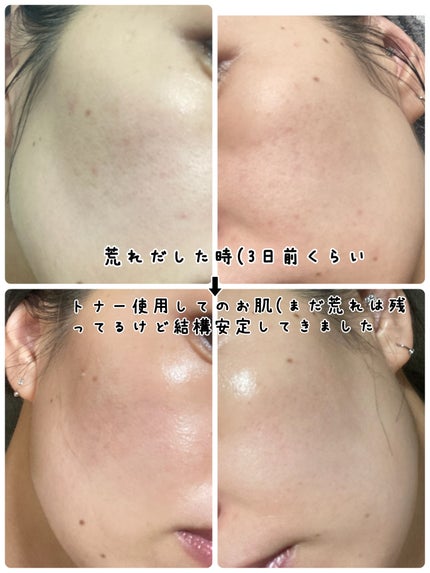 ピンクアロエビタトナー/APRILSKIN/化粧水を使ったクチコミ(3枚目)