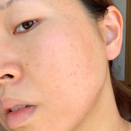 ハトムギ化粧水(ナチュリエ スキンコンディショナー R )/ナチュリエ/化粧水を使ったクチコミ(7枚目)